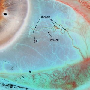 SCLEROLOGY BASICS COURSE