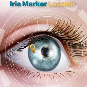 Iris Marker Locator